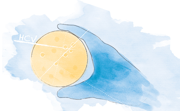 Hepatitis C Virus: Is the end in sight?
